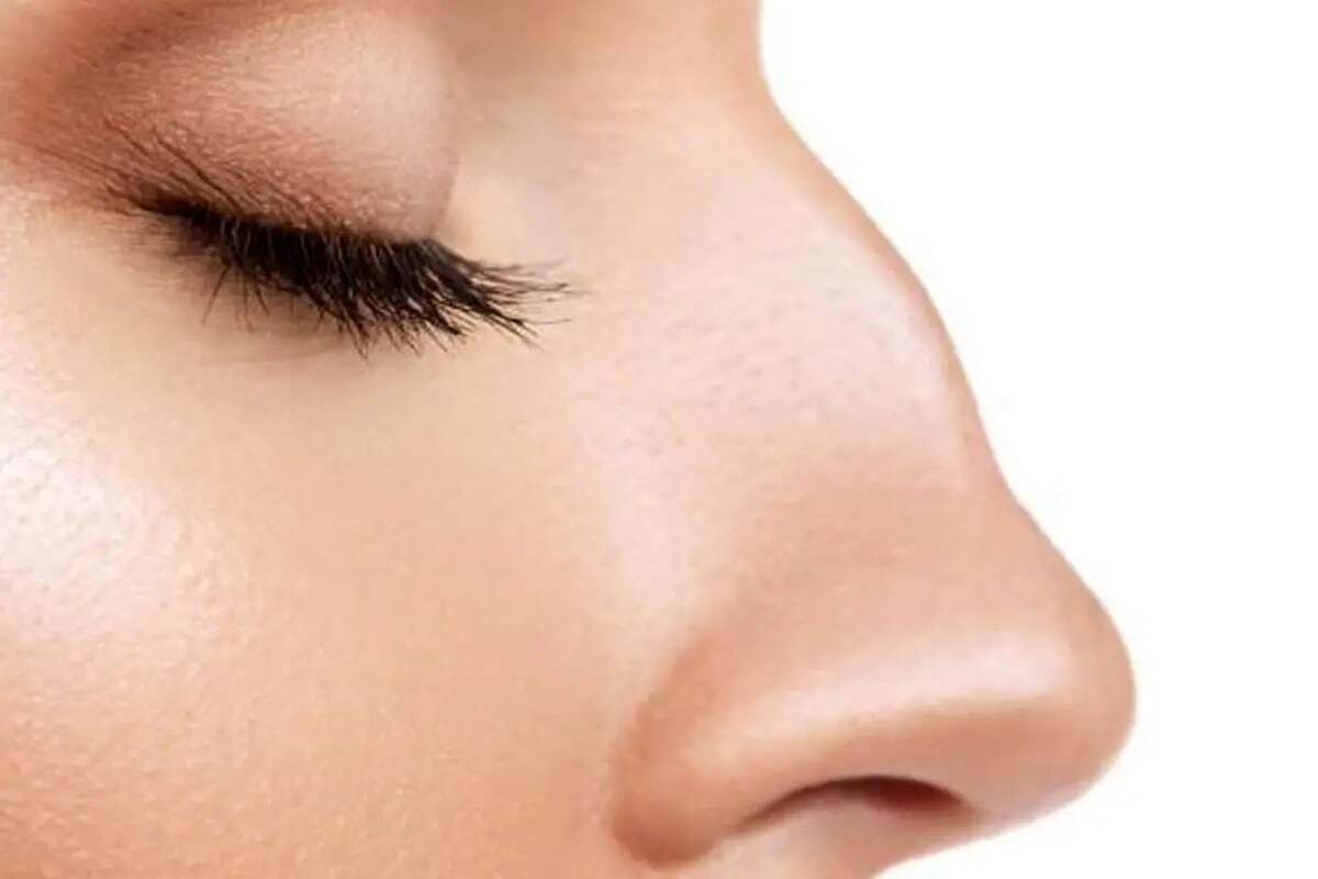 قوز بینی، ترند زیبایی سال ۲۰۲۶