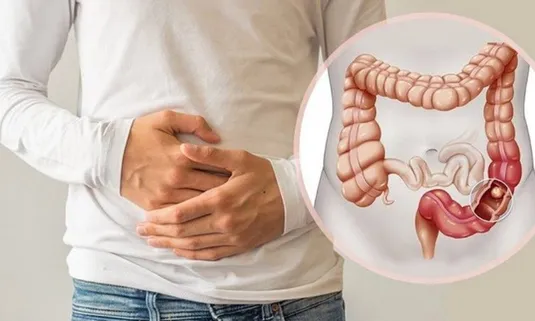چرا بعضی یبوست&zwnj;ها درمان سخت&zwnj;تری دارند؟