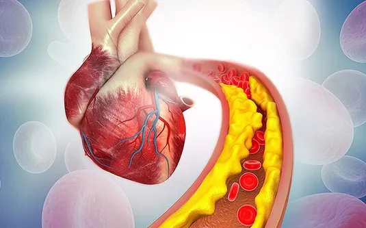 بدترین خوراکی&zwnj;ها برای افزایش کلسترول خون کدامند؟